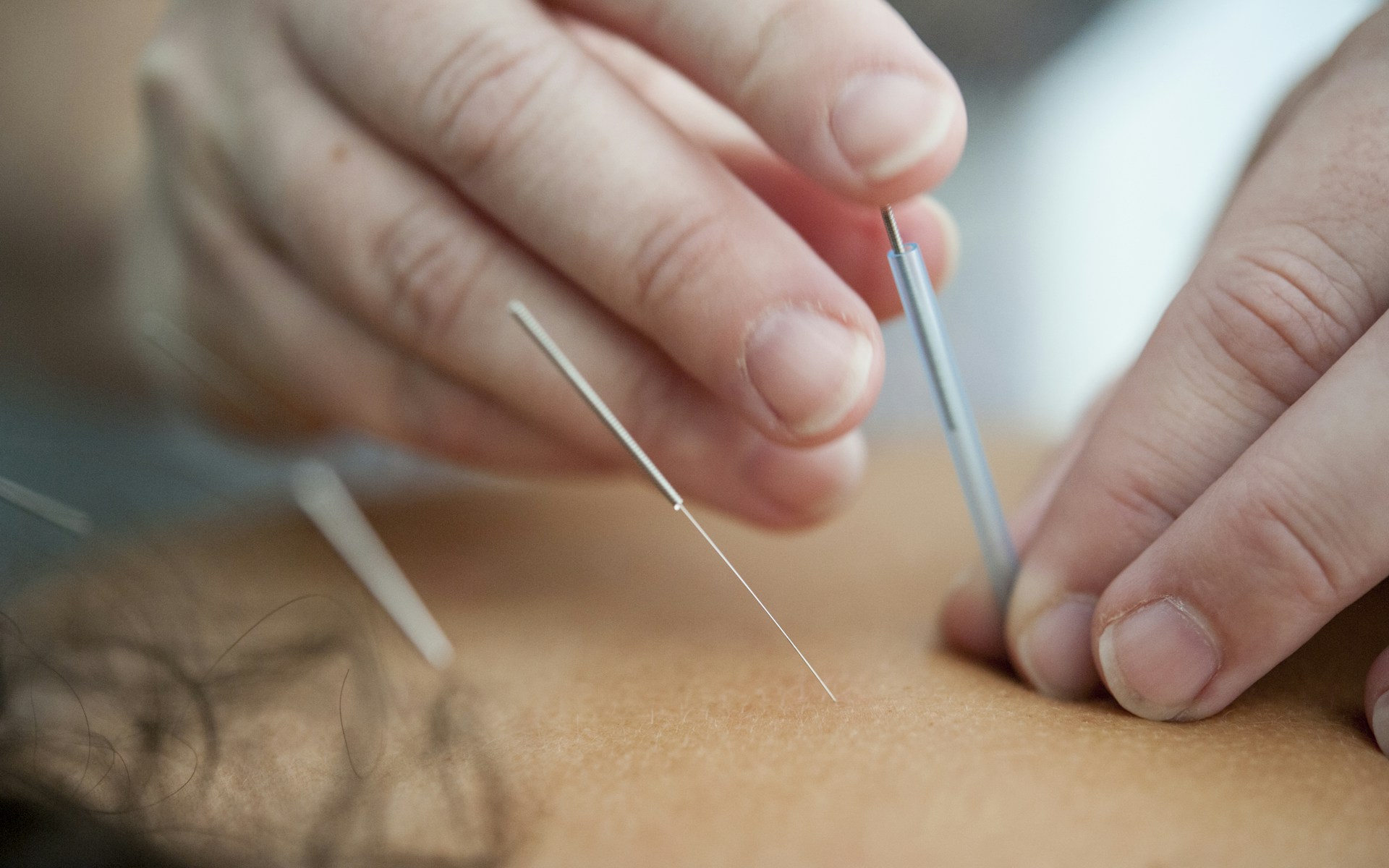 Acupuncture website template preview